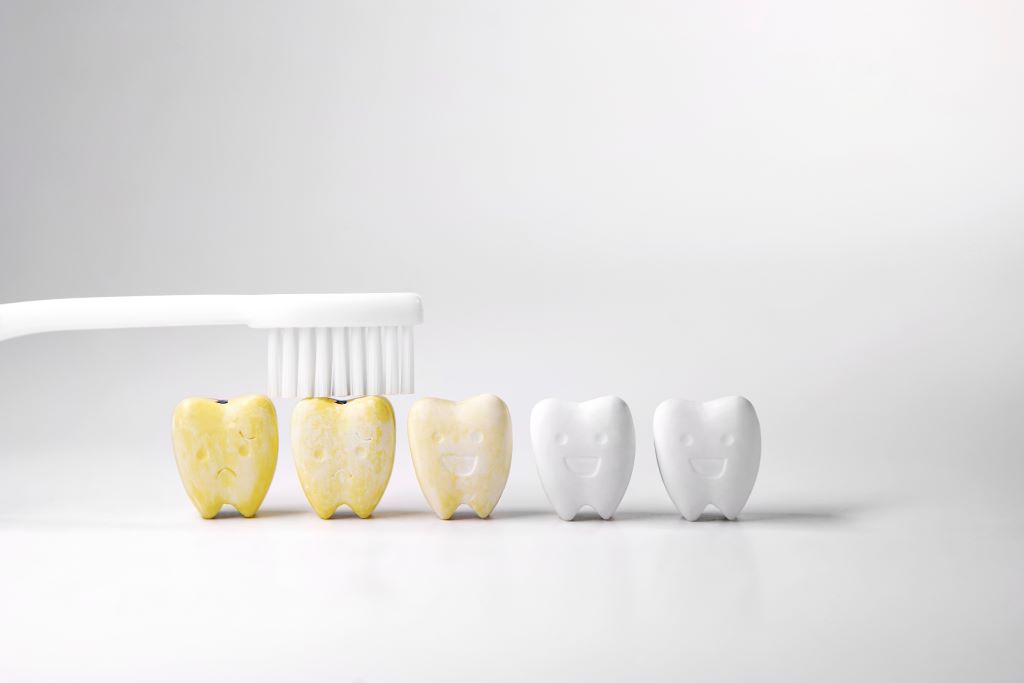 Teeth Whitening