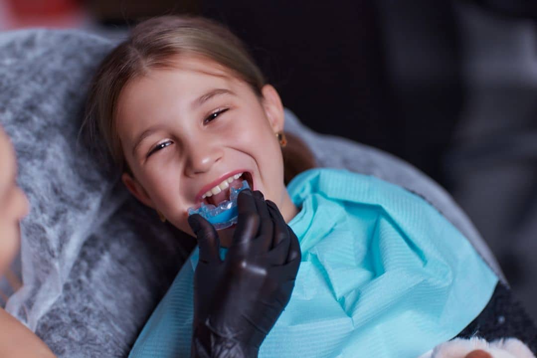 Dental Guards in Kelowna