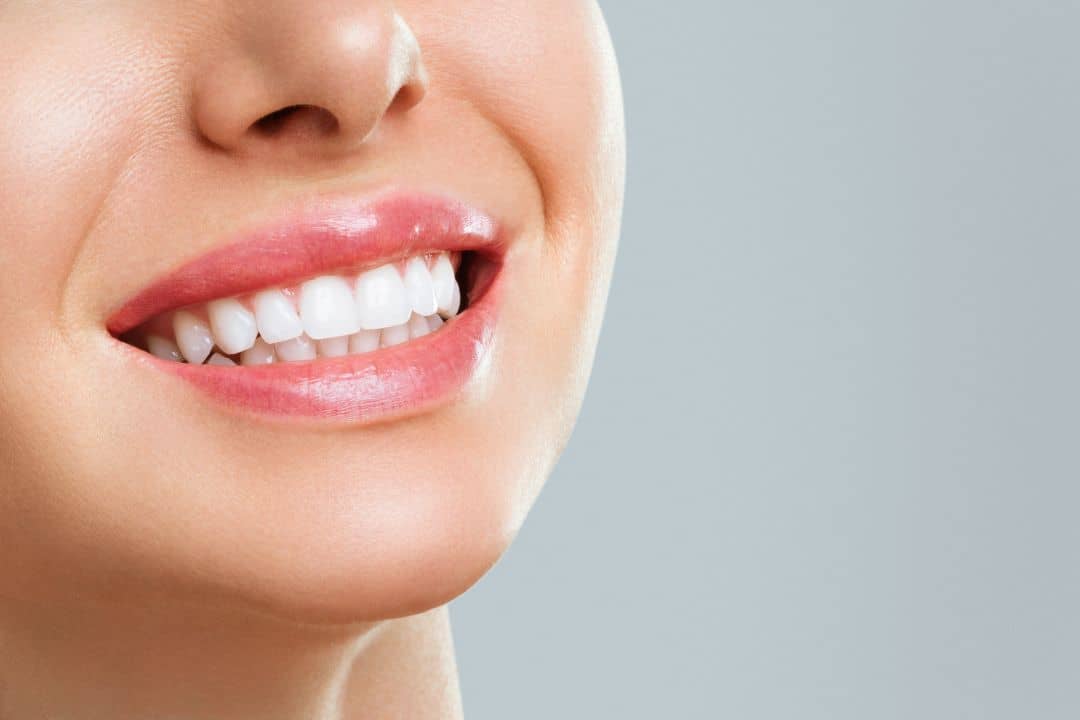 teeth whitening in kelowna