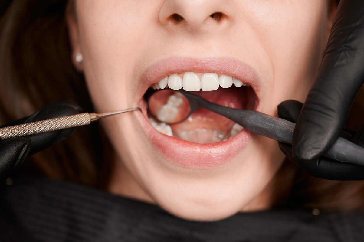 why do i need a gum and bone graft recognizing the signs and symptoms