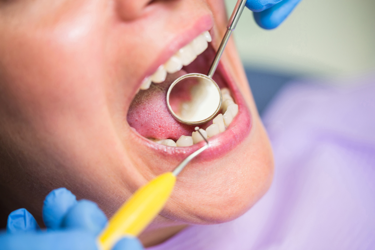 gum grafting vs bone grafting what s the difference and do you need one